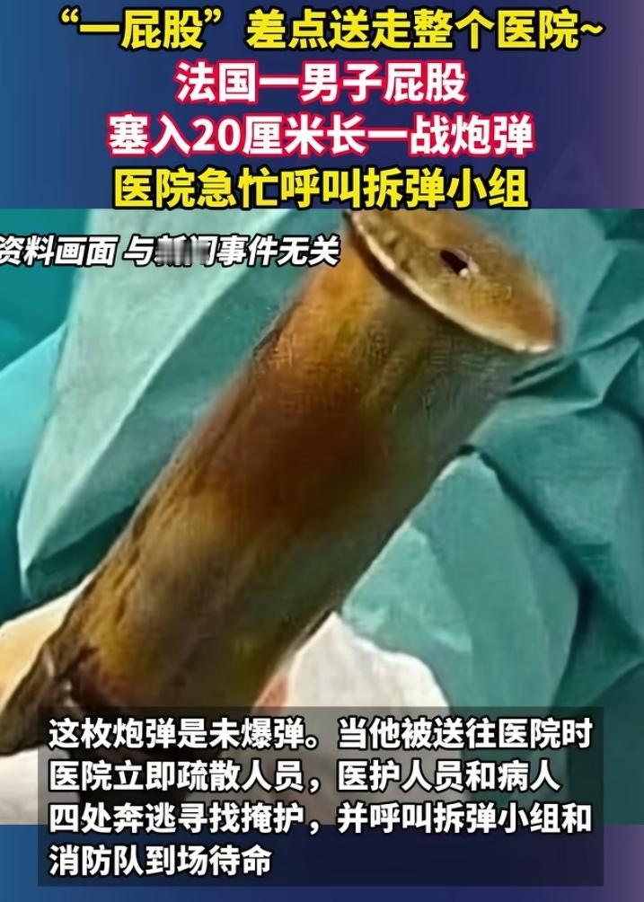真的活久见！法国一男子屁股塞入20厘米长一战时期炮弹，医院急忙呼叫拆弹小组和消防
