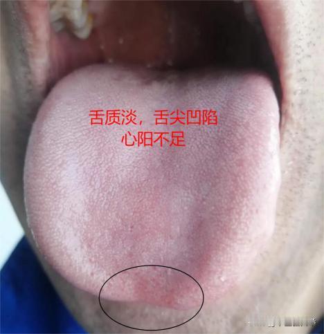 夏天是补阳“黄金期”，分享最全补阳方案，从头到脚补阳气，中老年人收好
年龄越大的