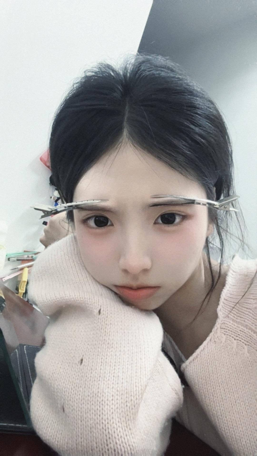 偏头痛就像有个小人在我的头上蹦迪 857857 苏喂苏喂