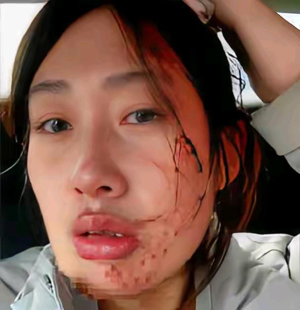 这个小护士也是一个孩子啊，就因为扎针出了错，被孩子家长直接打的头破血流。这个护士