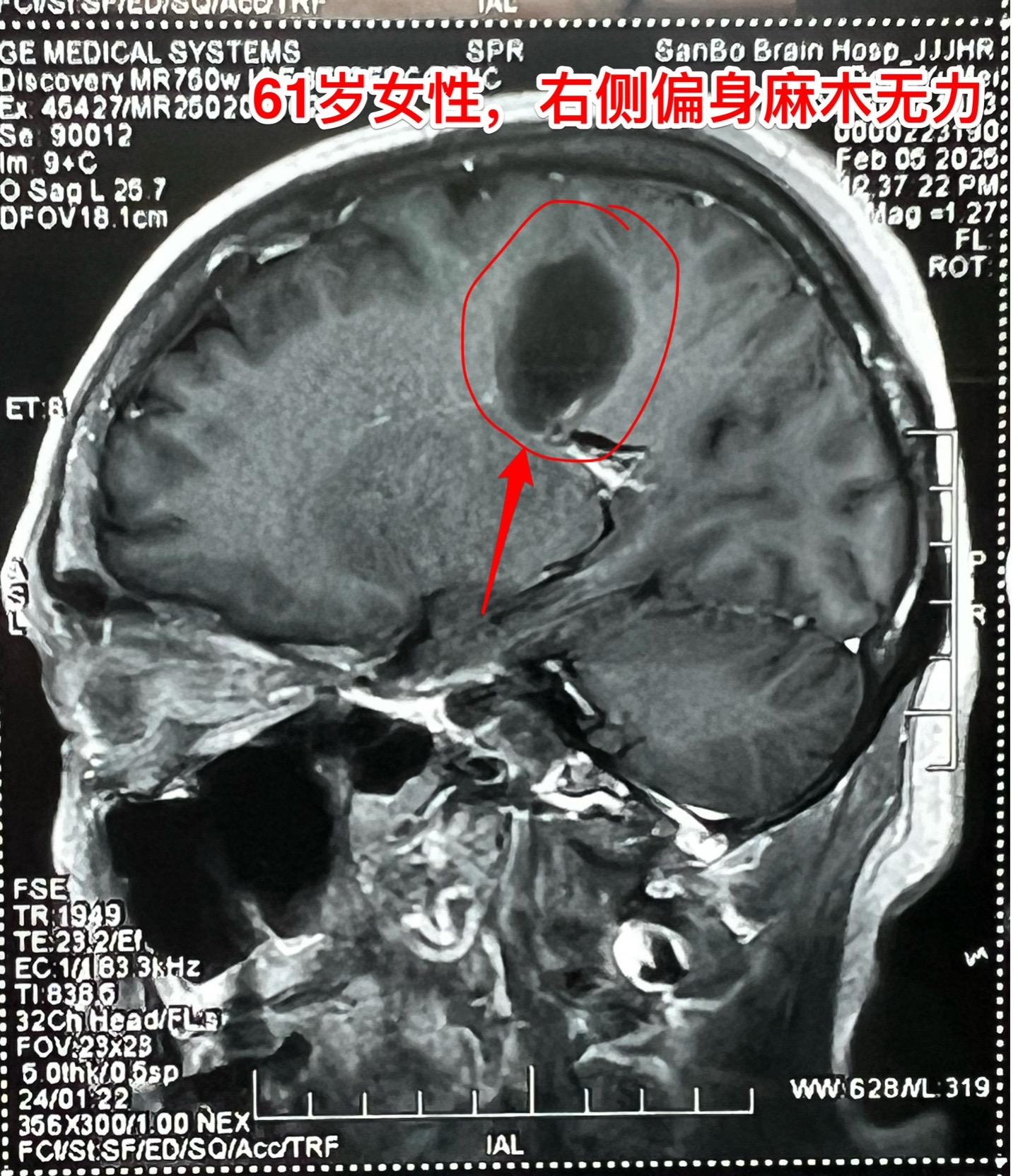 疾病多种多样，鉴别诊断不易！近几年人工智能AI发展迅猛，成果惊人！  ...