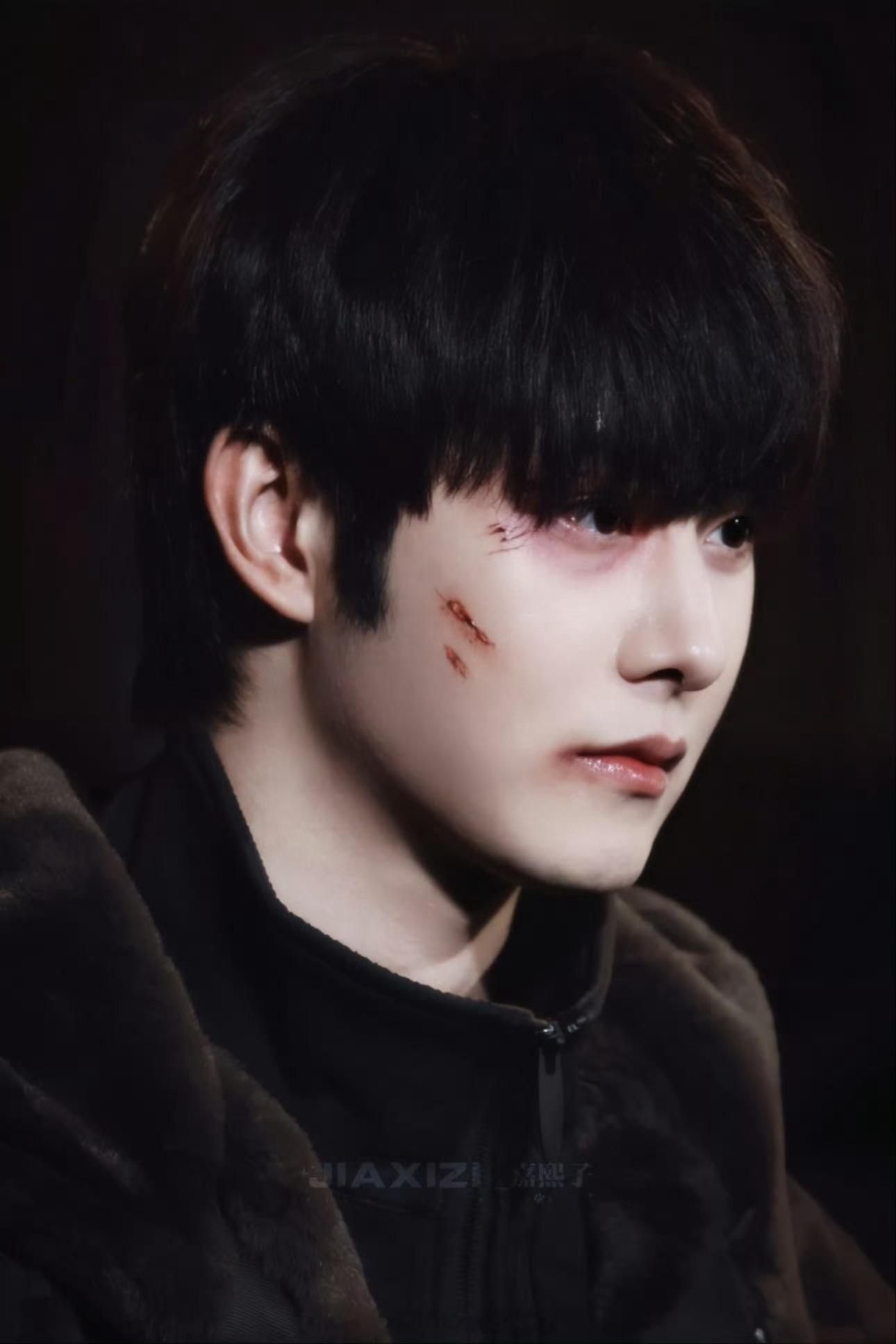 田嘉瑞一路灿烂，受伤版的李思博