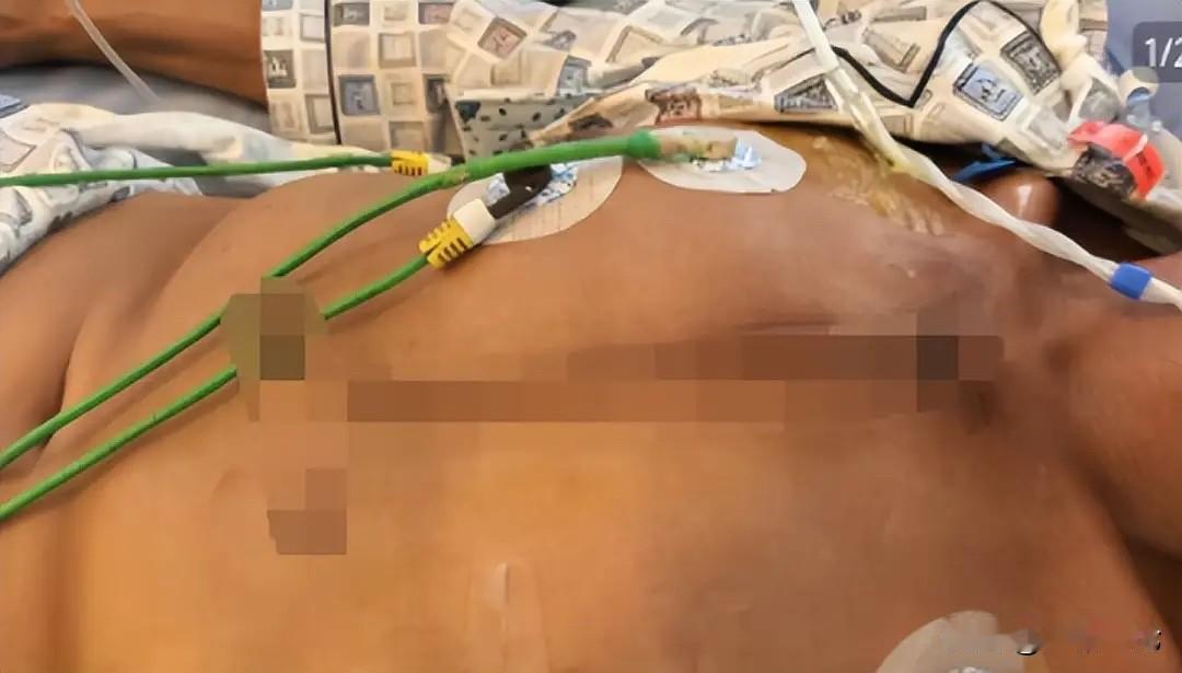 四川泸州，男子在自家二楼窗边坐得好好的，却突然遭到枪击，那子弹穿过窗帘，直接打进