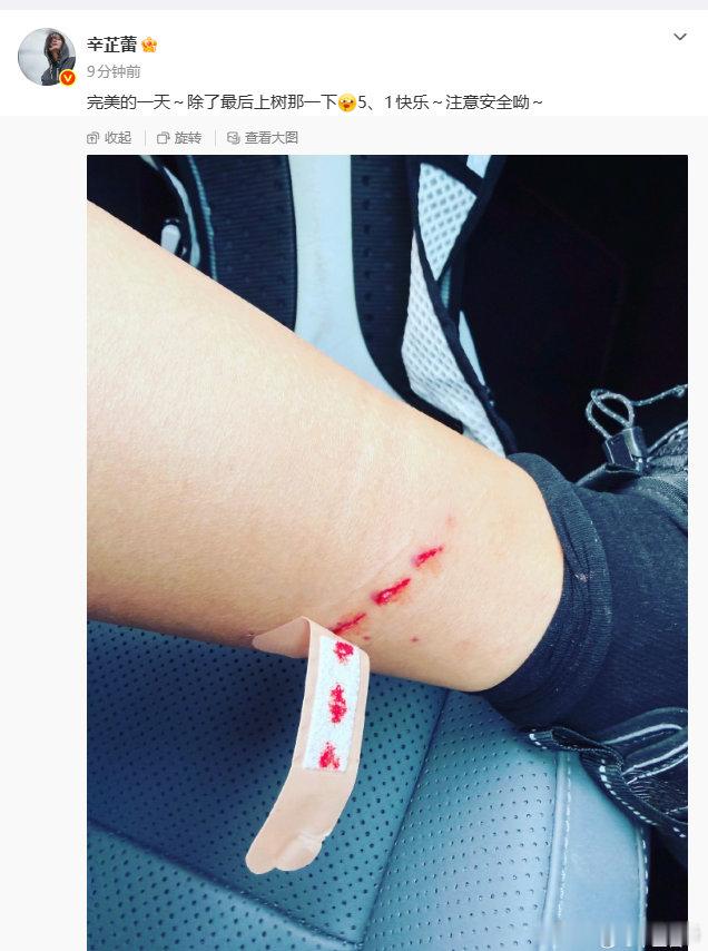 辛芷蕾爬树受伤了本来以为是去踏青，结果直接上树了，辛芷蕾这精力旺盛得让人佩服，伤