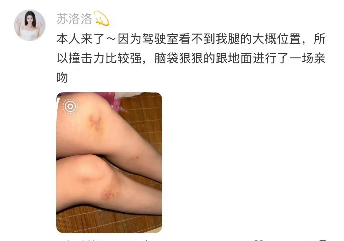 短剧车祸戏居然是真撞属实看愣了，短剧拍摄车祸戏份居然直接真人真撞。演员自己出来说