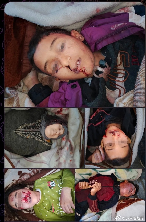 【画面血腥，谨慎观看】这是2025年的叙利亚 叙利亚爆发大规模报复性仇杀叙利亚爆