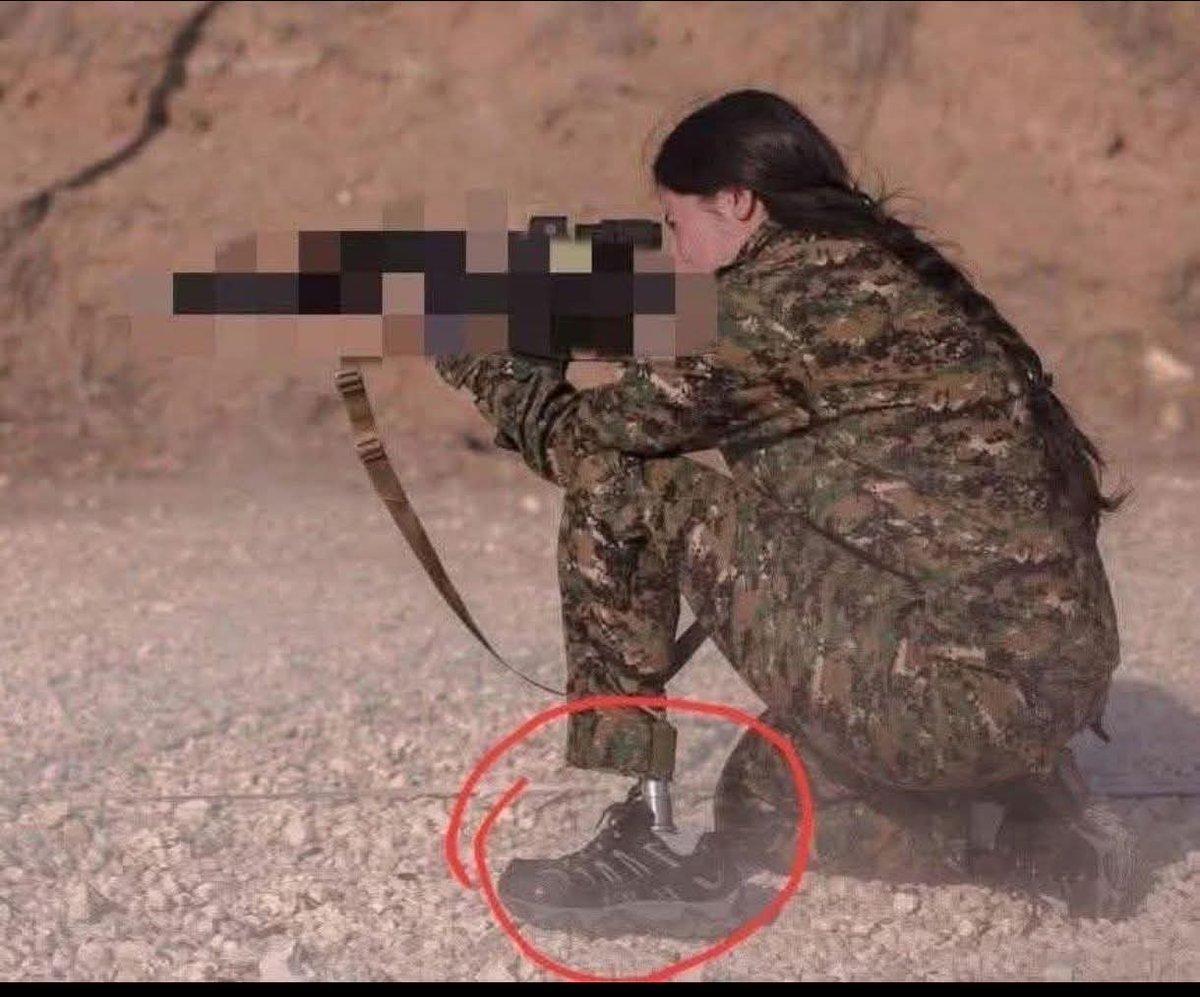 一名在阿勒颇持续冲突中受伤的库尔德女战士，图片中展示了她的假肢（圈起来），以强调