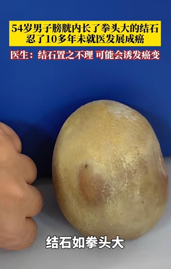 “悲剧还是发生了！”5月26日报道，广西，一男子在过去十多年，就出现尿痛及排尿不