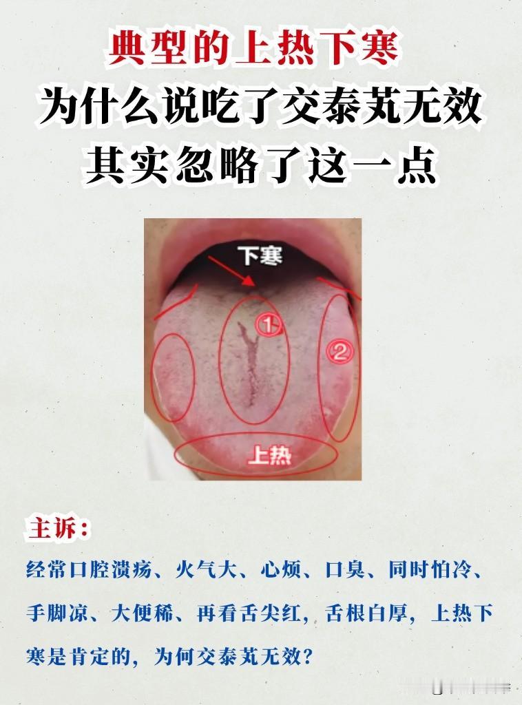 上半身热，下半身寒，明明上热下寒交泰丸却没效果？原因都在舌头上
#中医##健康#