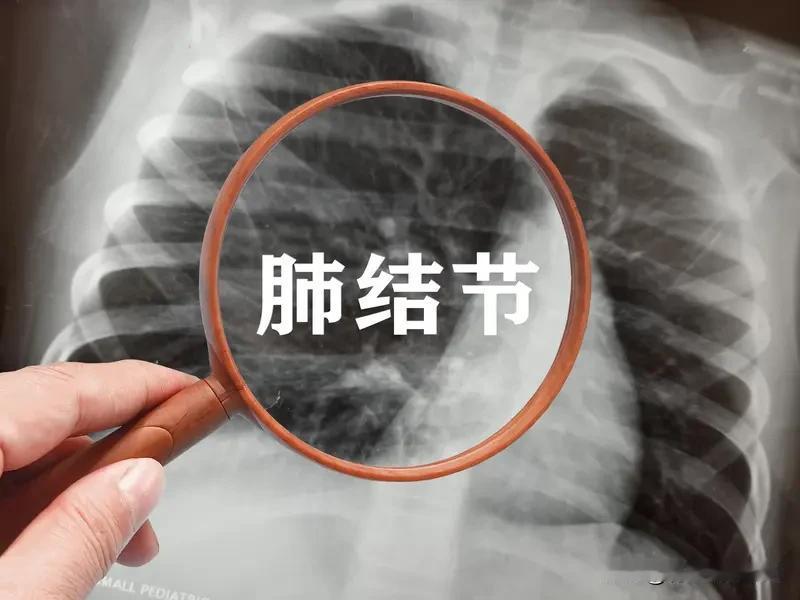 结节不用慌！10个散结中成药，大白话唠明白，不同结节对应选
 
不管是肺上、乳腺