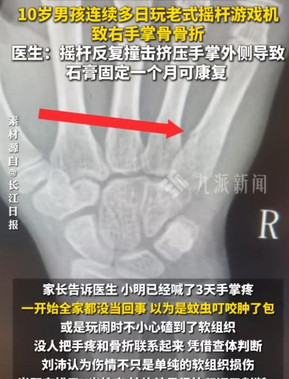 “真的大开眼界！”一名10岁小男孩连续几天在家玩老式摇杆游戏机，沉迷格斗游戏疯狂