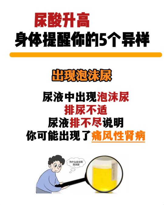 尿酸悄悄升高时，身体会发出这 5 个提醒信号