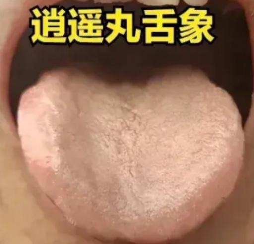肝郁，逍遥还是柴胡疏肝，一次讲明白！

逍遥散-------脾虚，肝郁，血虚之人