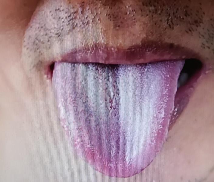 最近老感觉困，睡不够，心里那叫一个烦啊！就像被瞌睡虫缠上了，干啥都提不起劲。不过