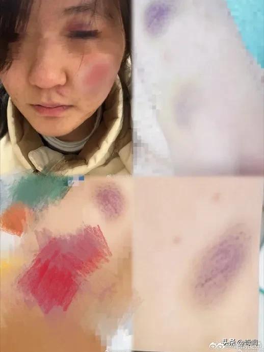 17岁女生自称被江西财大法学系男友殴打强奸，报案后警方不刑事立案，十分害怕再次受