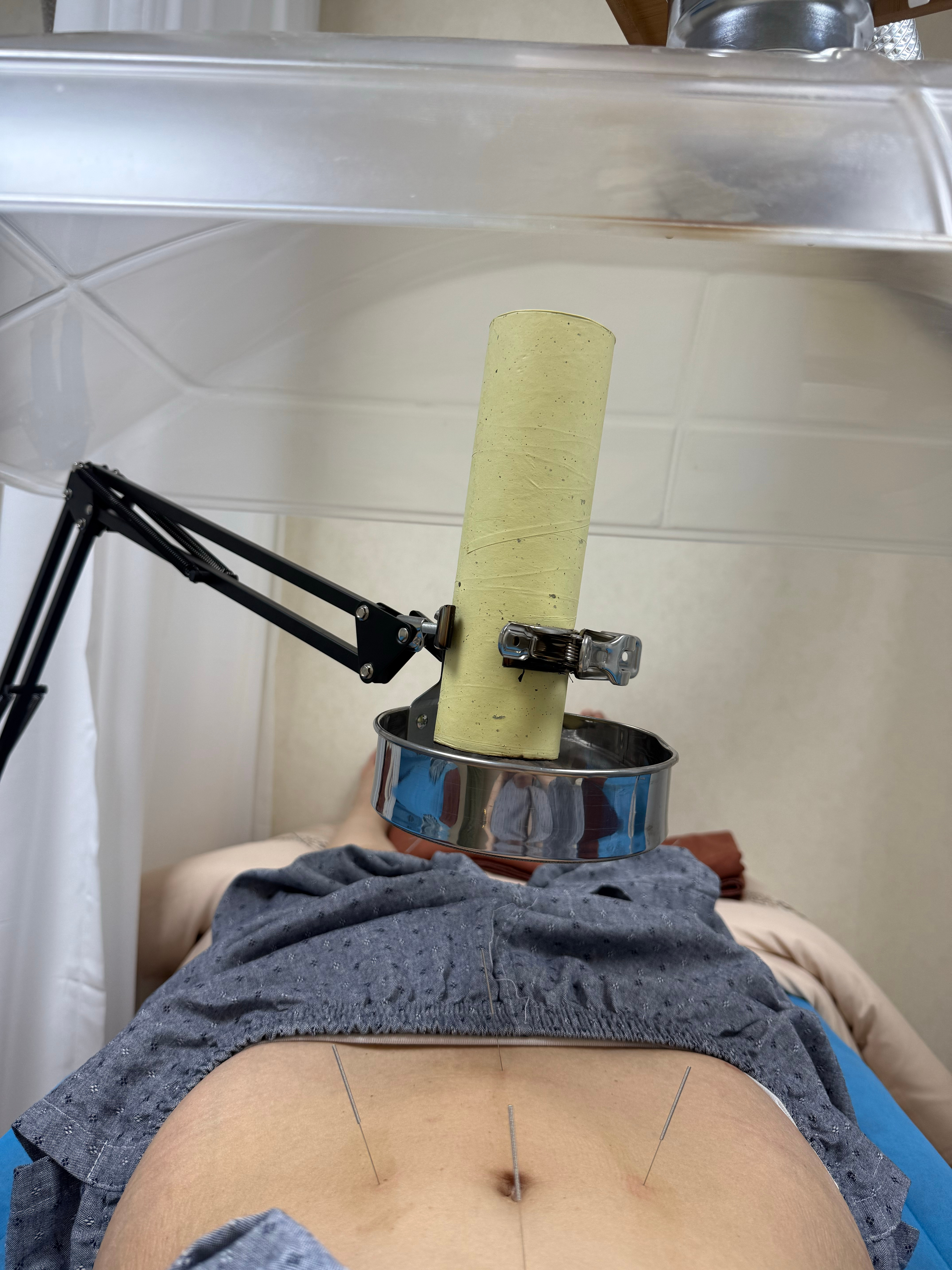 我老天！！！去中医院医生把脉说要调理脾胃，还要改善四肢湿气，一顿速度扎针，其实不