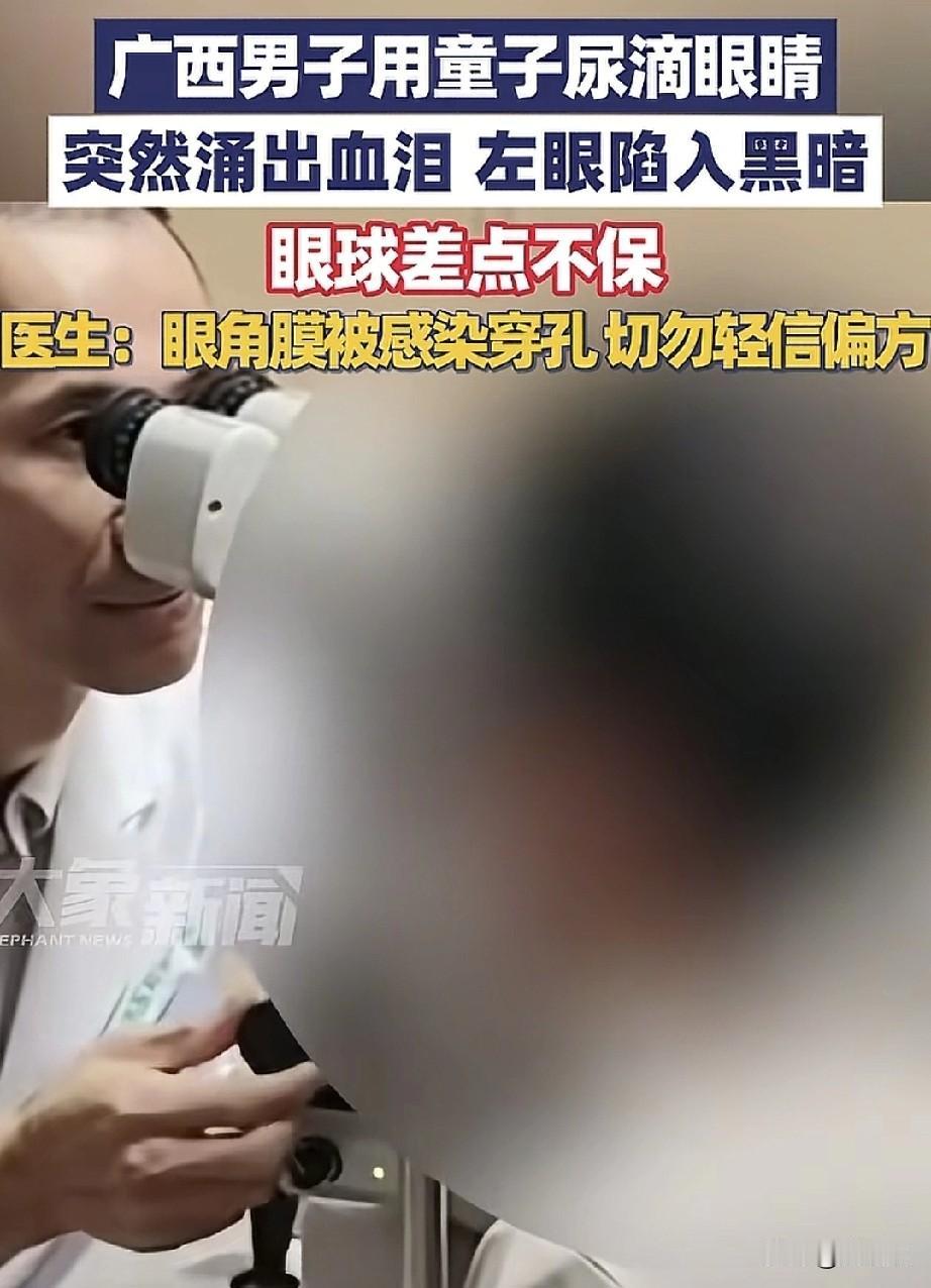 广西老表这波操作太离谱了！
这都2025年了，
怎么还会有人轻信偏方，相信童子尿