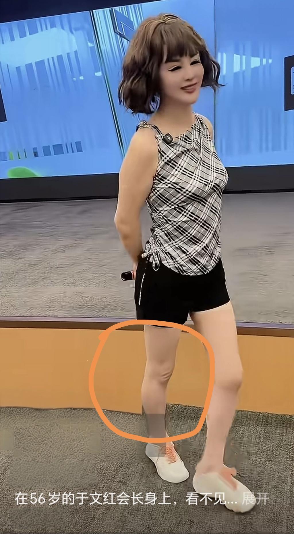 于文红整容那么多次，不说给那膝盖整整，看那膝盖皱巴的，看了她的膝盖，我隔着屏幕闻