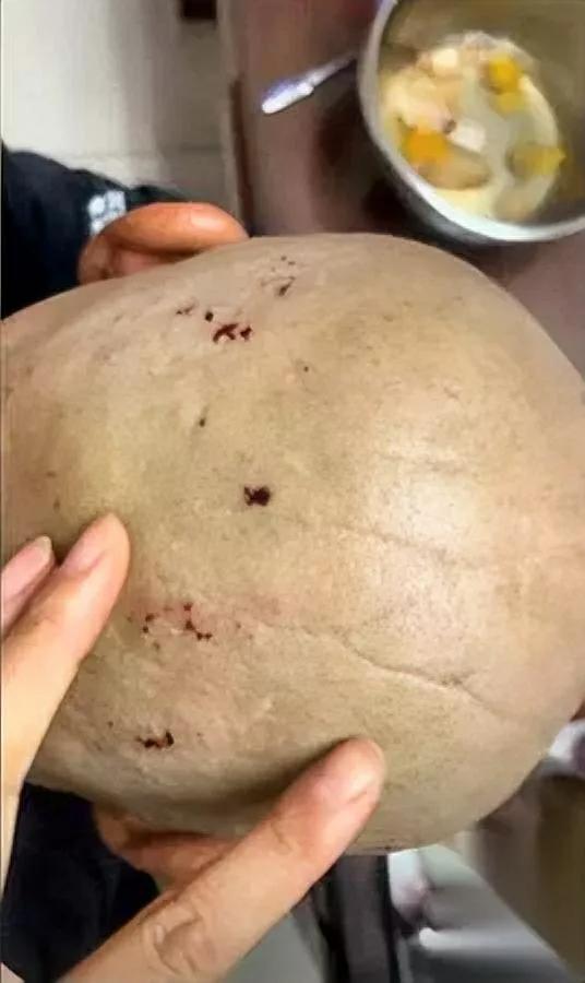 大爷剃头后满头贴创可贴

女儿想理论却被拦住

凑近一看全是剃头划的伤口！天津6