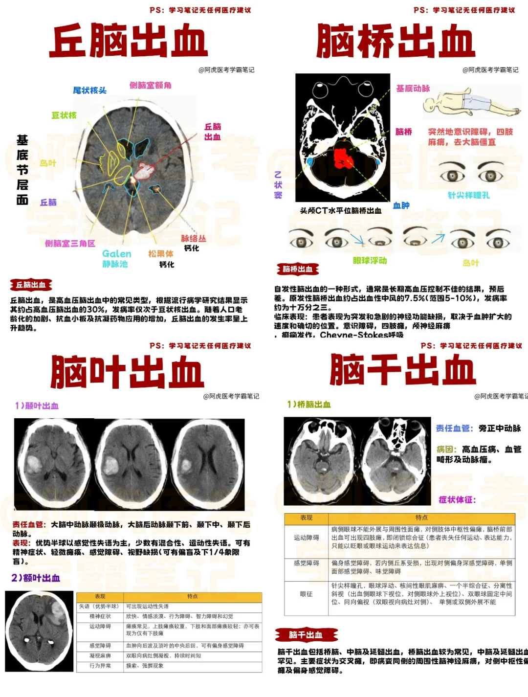 医学生笔记📒｜脑出血合集👆