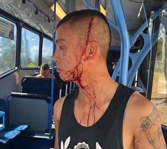 中国拳王在澳遭袭
金腰带卫冕战被迫取消

中国首位00后洲际拳王周润琪，在澳大利