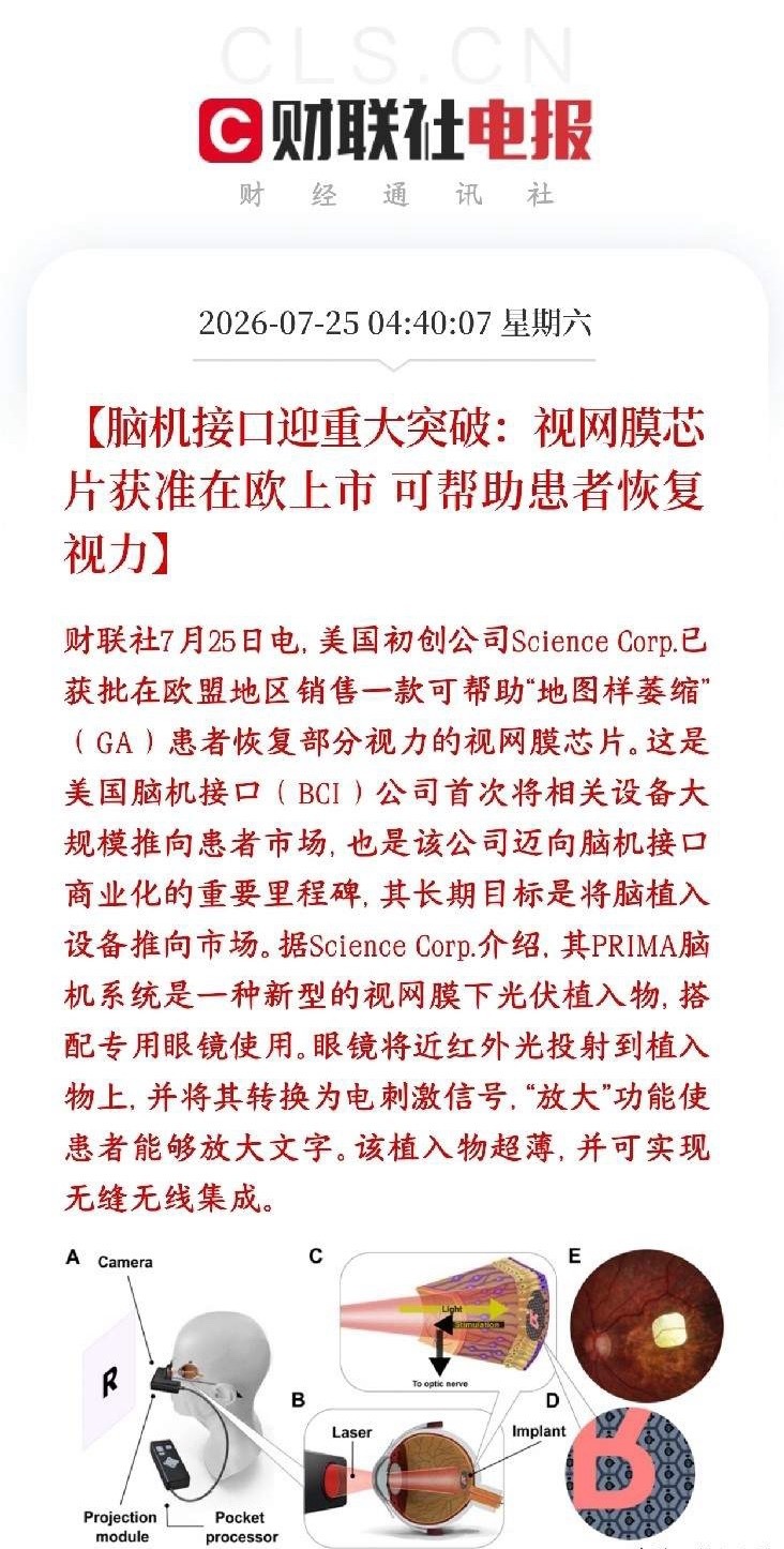 周末，脑机接口传出商用的消息，A股相关概念下周有望反弹美国研发脑机接口设备的企业