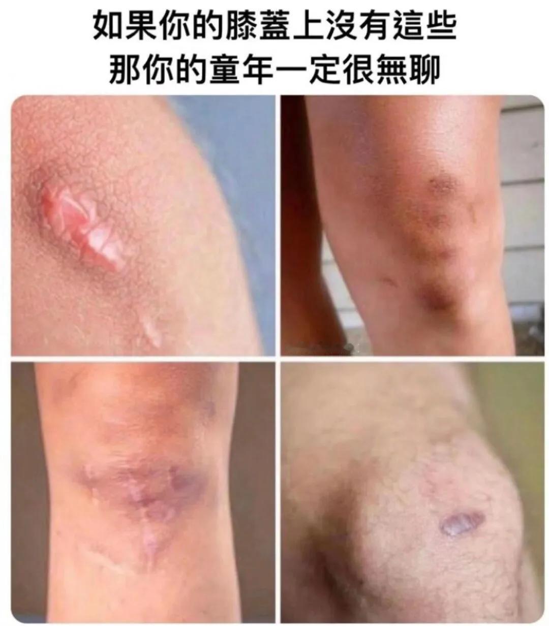 你童年是这样吗？？？