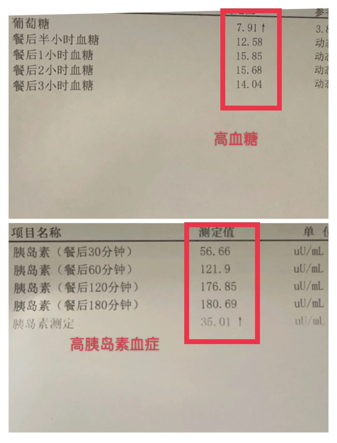 不同人对待胰岛素抵抗的不同态度