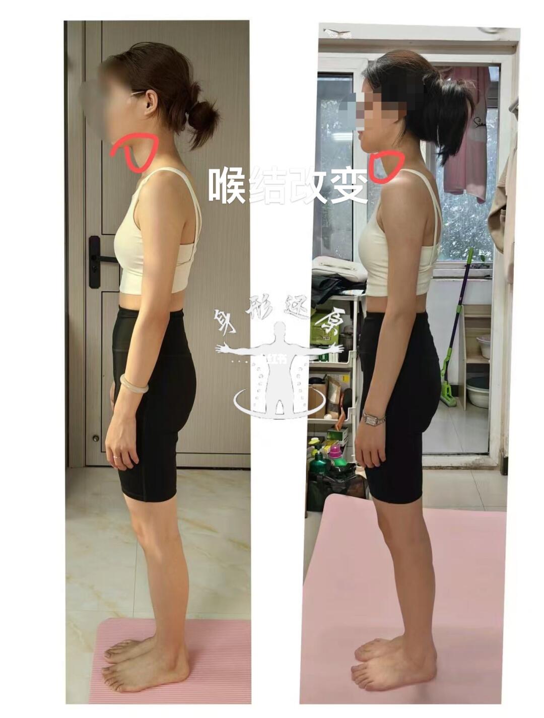 喉结，骨盆，扁头，不妨从骨盆操开始