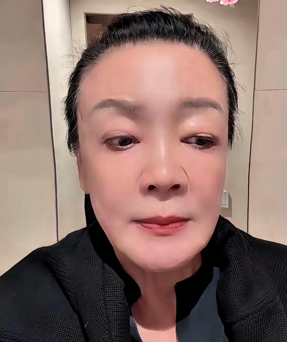 天气转冷，不少人不慎着凉感冒，张兰也没能幸免。为了快点痊愈，她做了一件让网友捏一