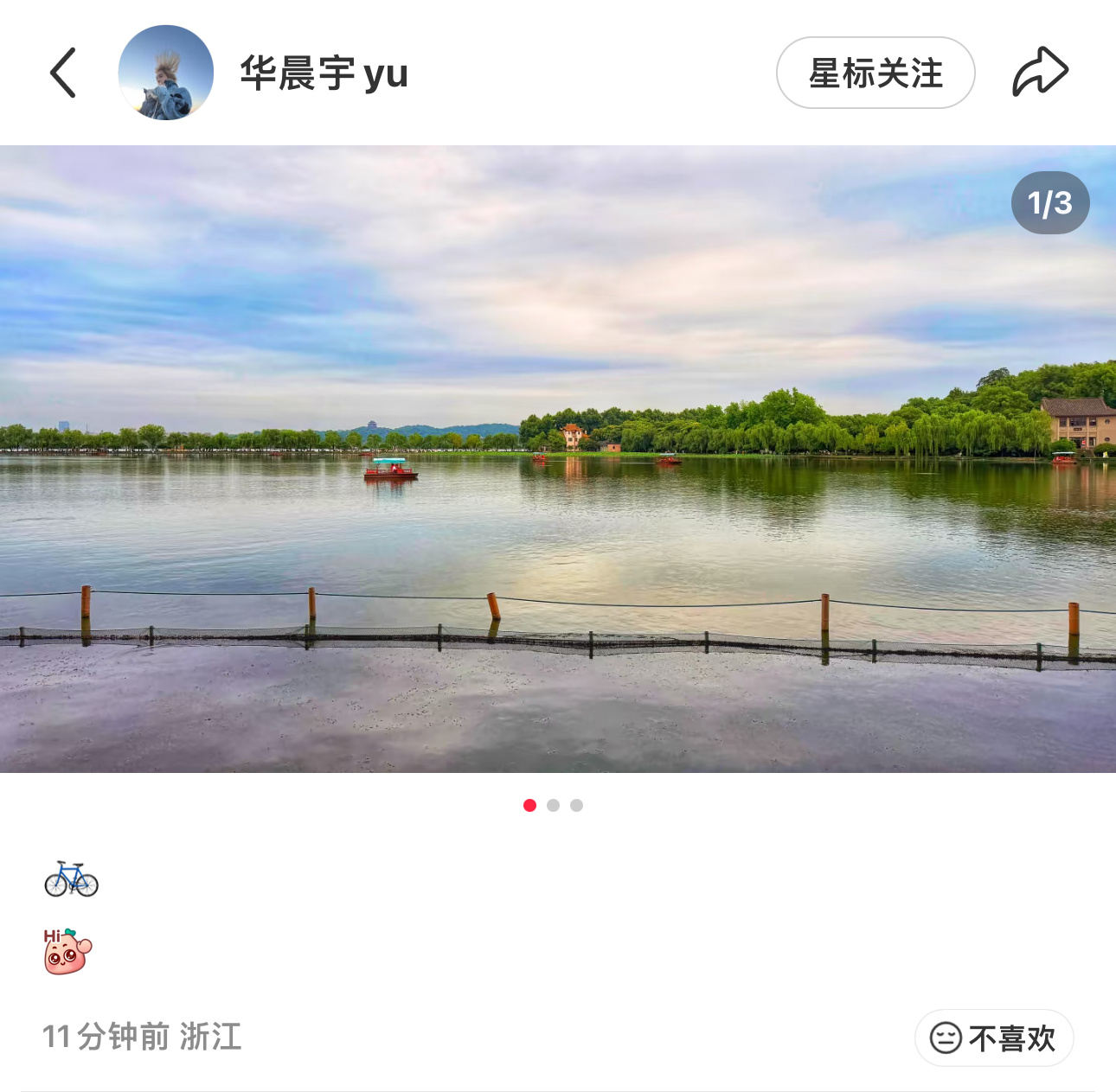 不热吗宝宝哈哈哈哈哈哈哈还能出来骑车（P3宝宝是戴手表了吗🥰 