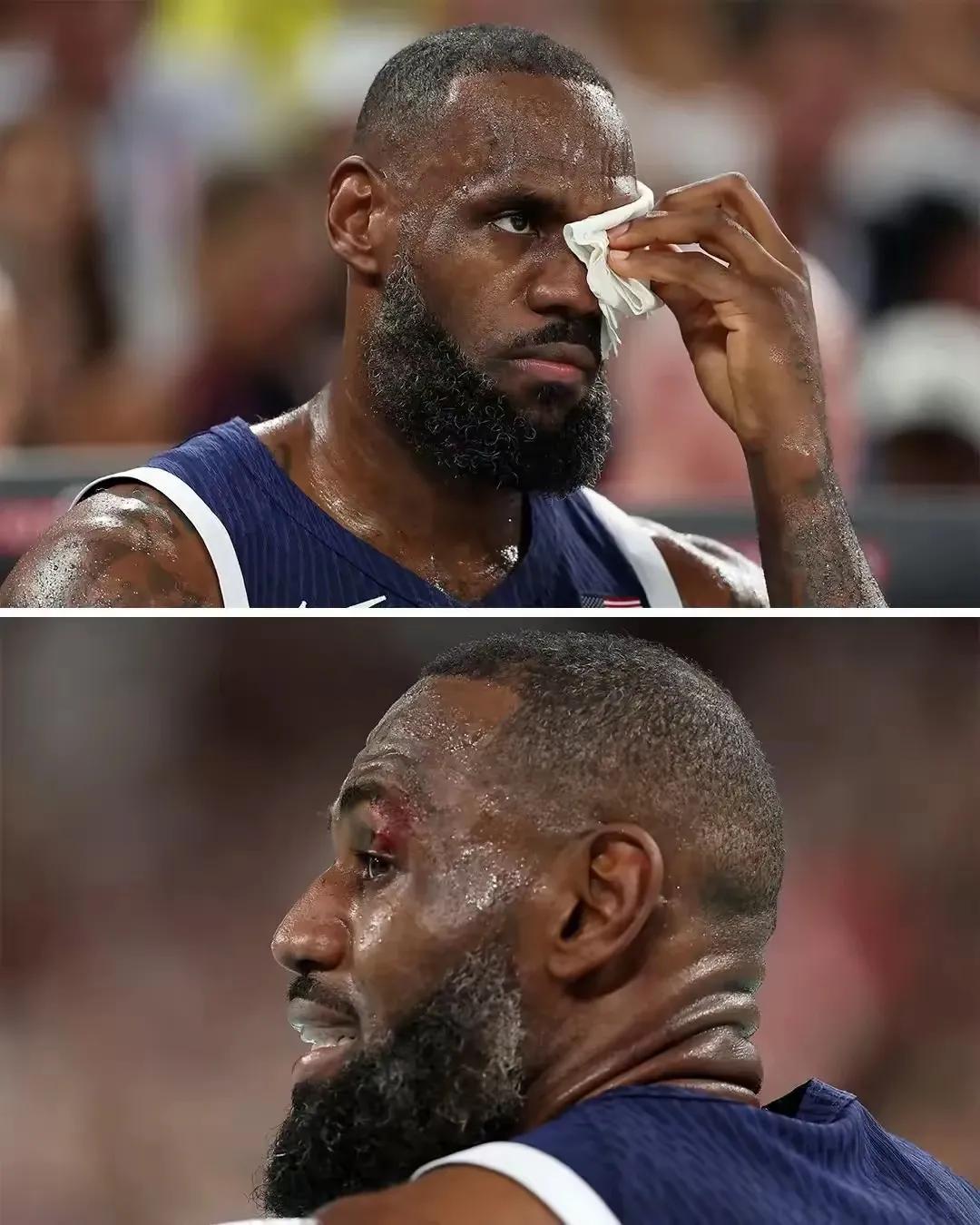 美国以122-87轻取巴西晋级四强，半决赛将对阵塞尔维亚，这场比赛不得不说的三个