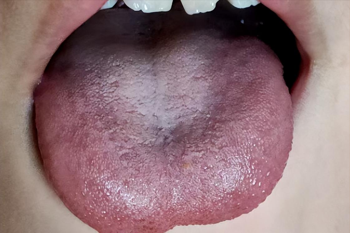 从小到大容易出汗的男孩，经方思维七剂止汗

看诊一男孩，其母亲说孩子从小就有个问