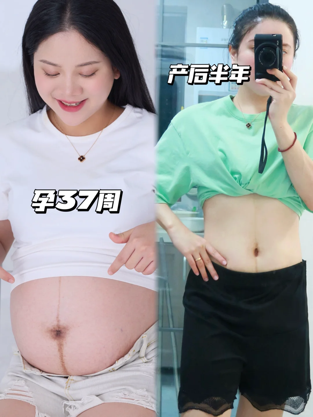 希望有妊娠纹的姐妹能刷到这条！