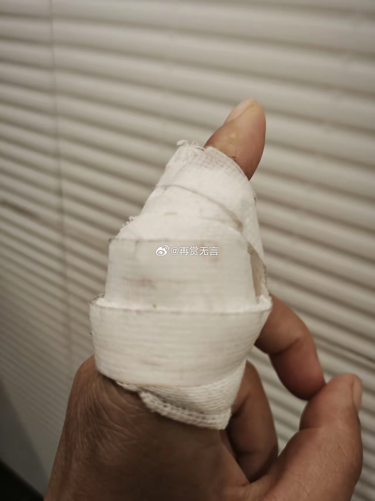 手受伤了，自己用专业知识缝合的，这个技术能在浙江找到工作吗？ 