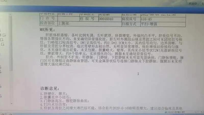 为什么肝硬化的结节在不断变大，但是各种指标检查没事，做了癌胚抗压，甲胎蛋白，糖类