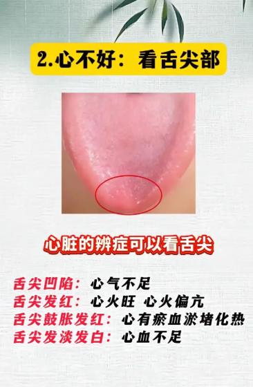 看舌辨脏腑：4 大部位对应健康