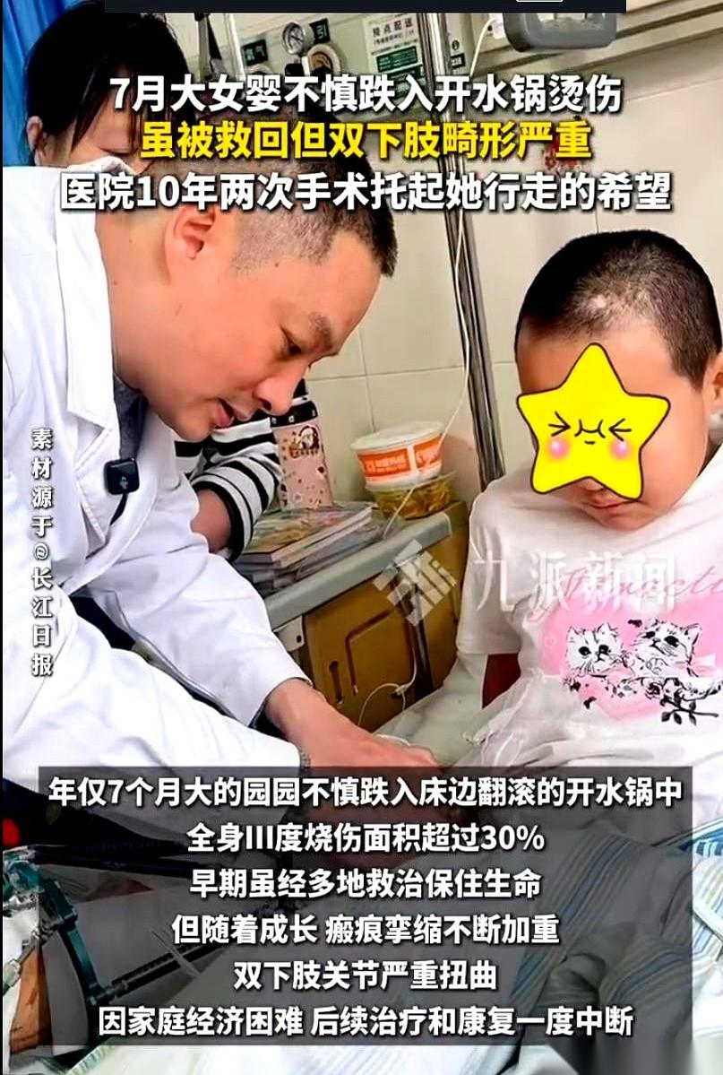 我勒个去！你们敢信吗？一个7个月大的小女婴，直接栽进了滚烫的开水锅！不是开玩笑，