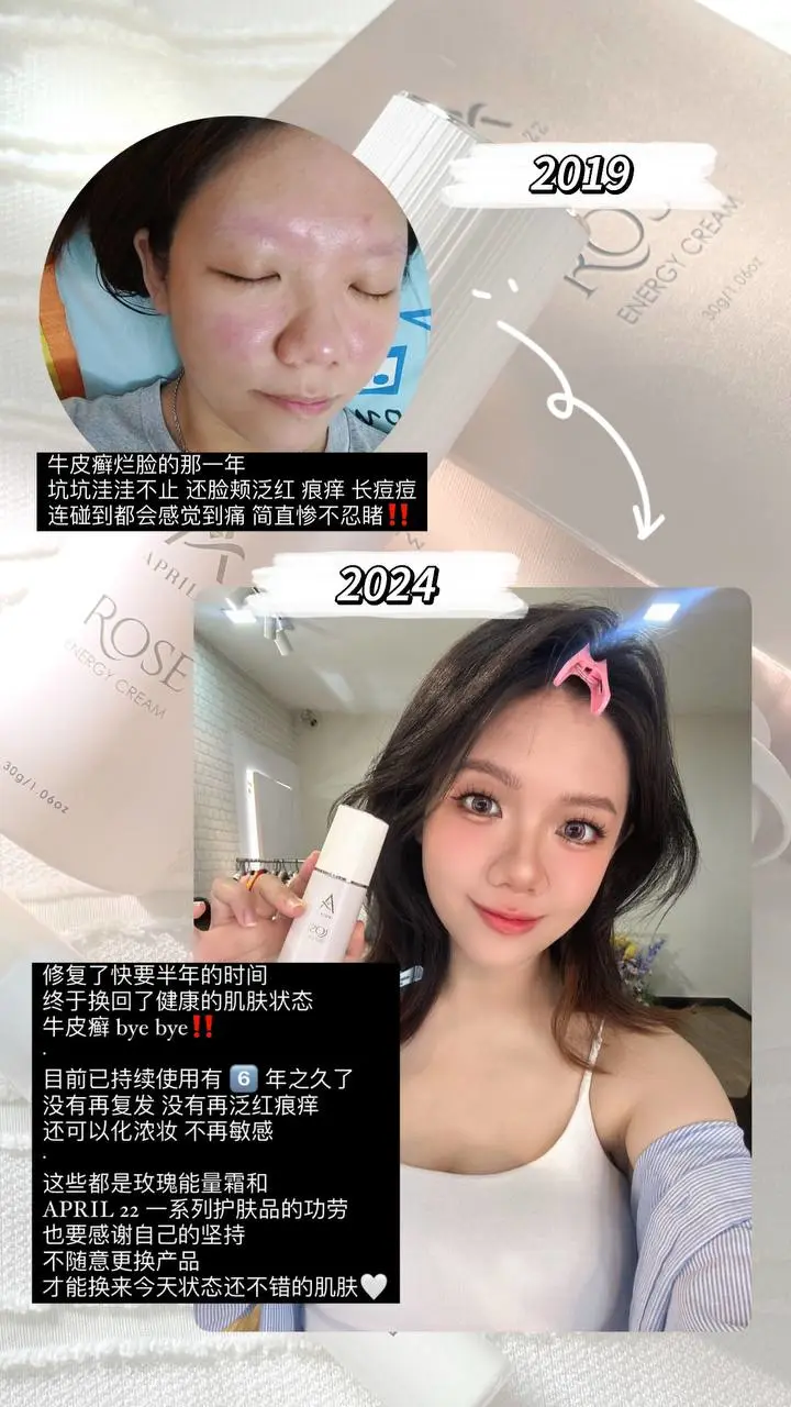 试用机会 | 抓紧不要错过！