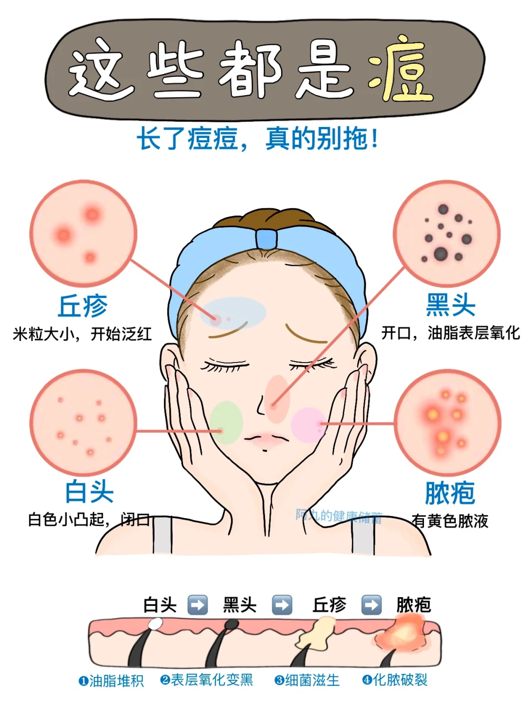 为什么你的痘痘越来越严重❓护理要趁早❗️