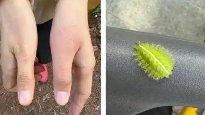 最近朋友圈和业主群里都在传一种虫子，名字叫"洋辣子"。听着挺土，蜇一下真能让人跳