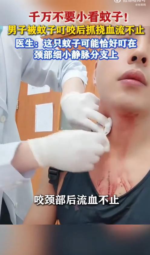 “哭笑不得！”7月20日报道，上海，一男子撸铁后被蚊子咬在脖子，不料竟咬中一根浅