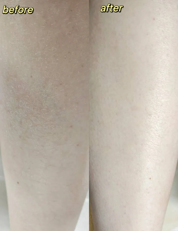 改善秋冬干燥起皮 它比贵妇身体乳厉害多了