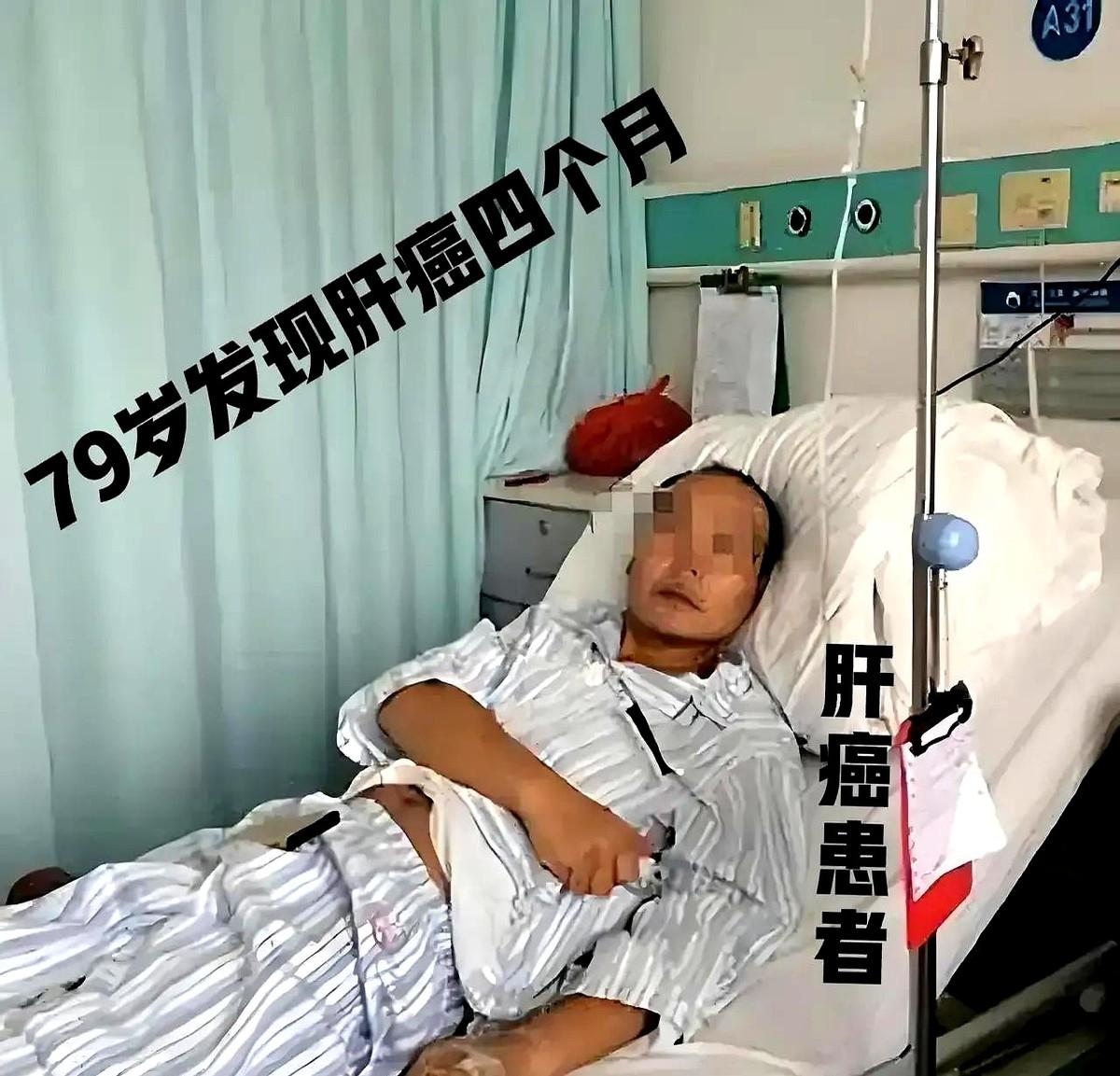 紧急求助民间中医，肝癌患者，医院检查确诊，已经4个月。

男♂️，79岁，肝区疼