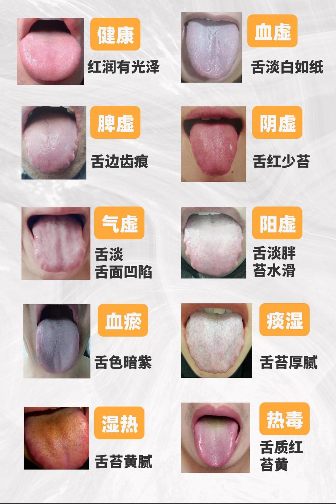 中医“四大虚”和“四大邪”，通过舌象一次讲清，一症对一药

首先，健康的舌象：舌