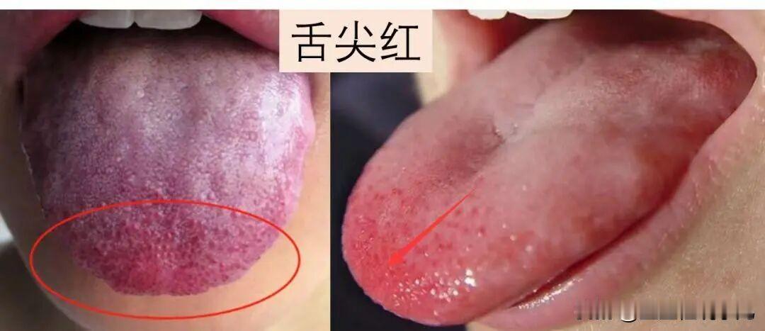 【1块钱煮三大碗！夏天给娃喝这个“神仙水”，清热不伤脾，孩子猛蹿个！】
大家好，