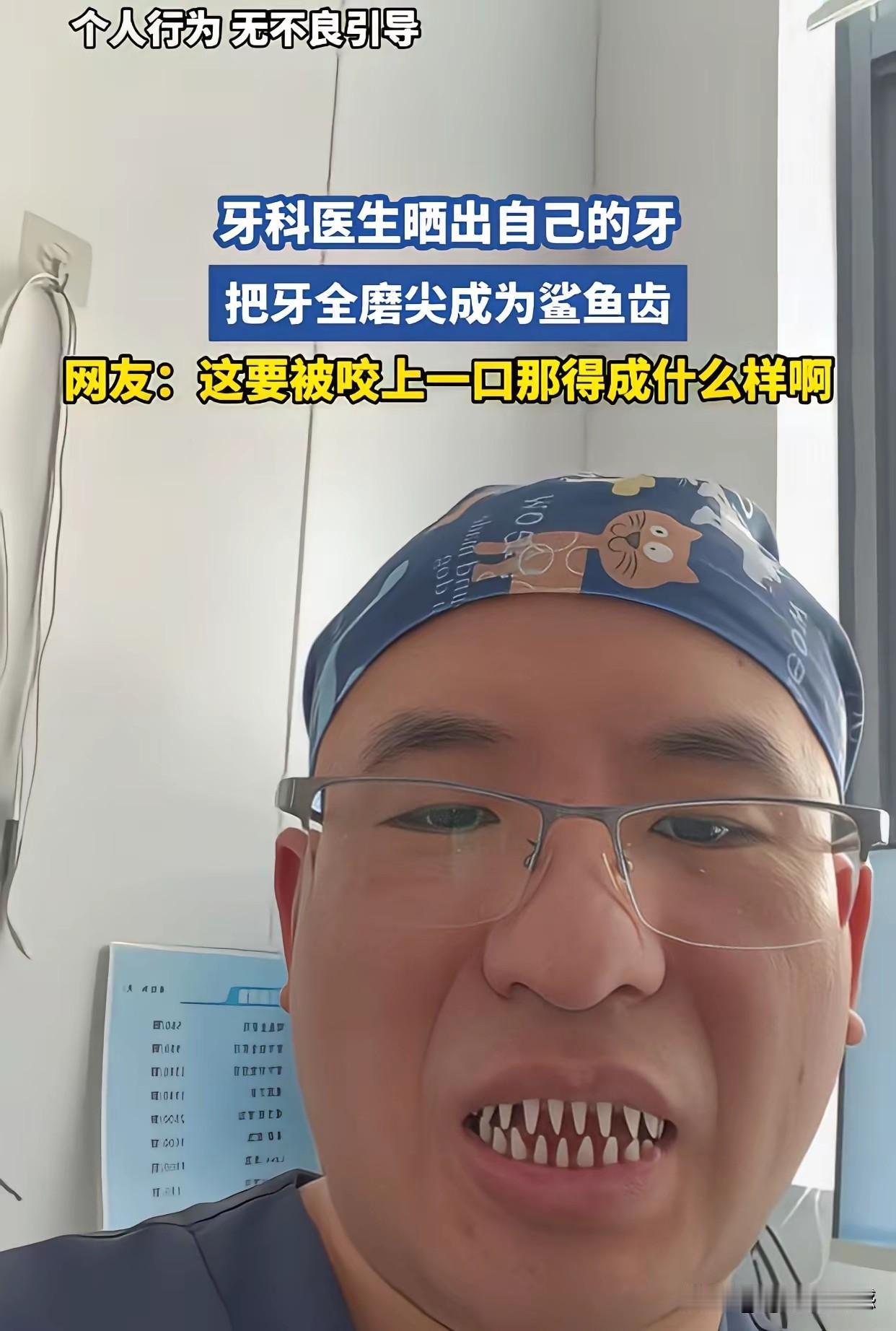 这个男子的这口牙，应该不是真牙，真牙如果修成这样的话，那整口牙就废了，把牙齿表面