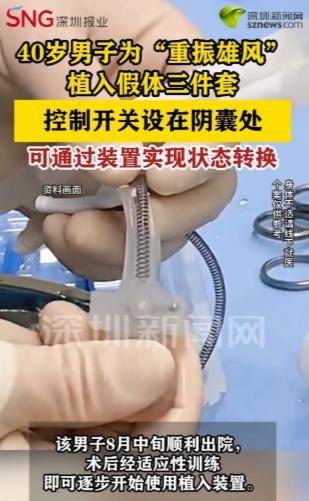 深圳，一名40岁男子看着妻子渴望的眼神，直接让医生给他植入假体三件套。有了这个，