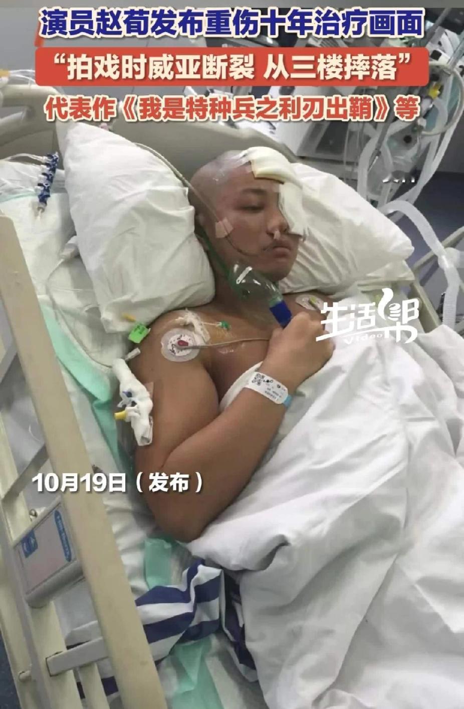 “李二牛”赵荀在拍摄《我是特种兵》时意外坠楼，竟奇迹般活了下来。如今，他公开了十