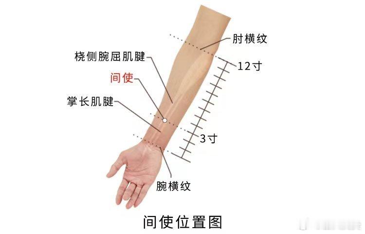  今日分享～间使穴精准取穴：在前臂前区，腕掌侧远端横纹上3寸，掌长肌腱与桡侧腕屈